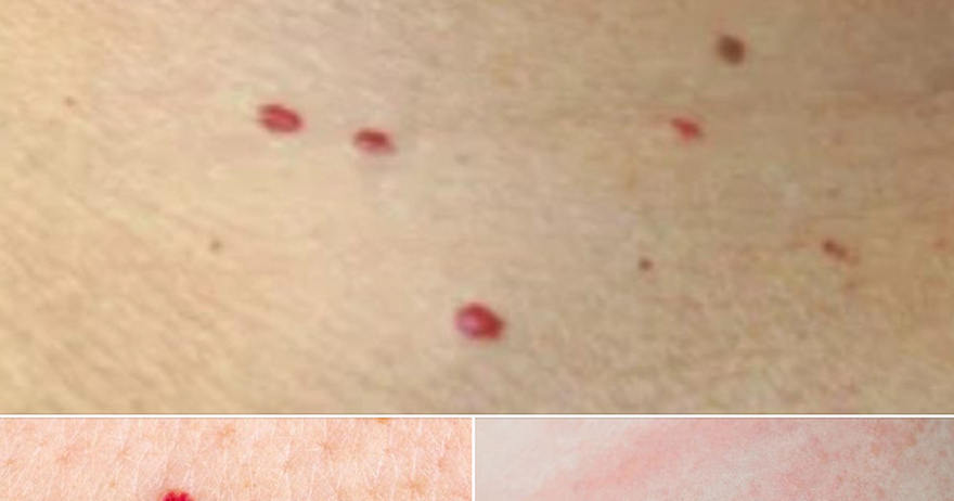 If you spot these red dots on your skin, here’s what they really mean