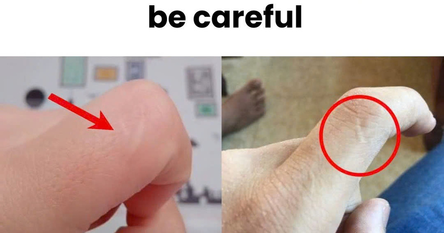 Anyone with this scar should be careful…