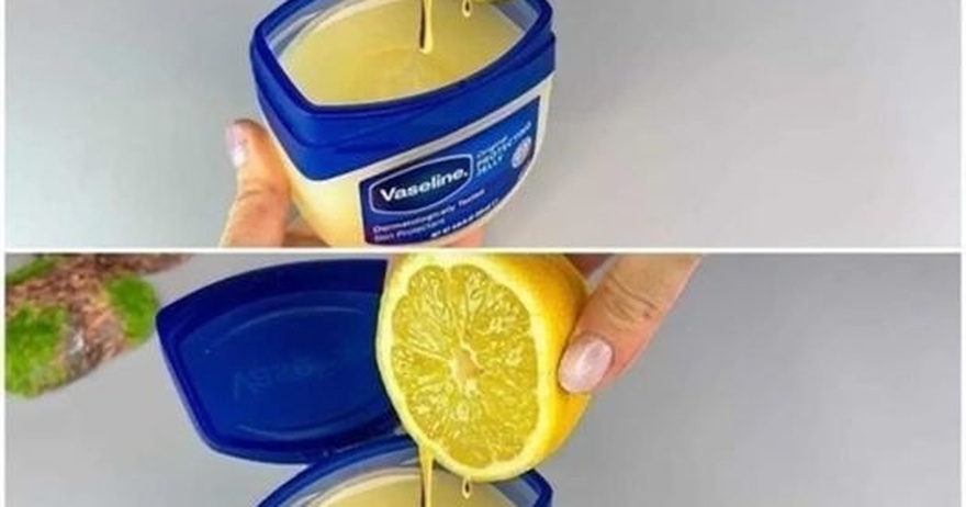 Just Mix Vaseline with Lemon and you will be shocked! Method in the first comment