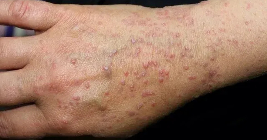 If You Have These Tiny Red Dots On Your Arm, Do Not Ignore The Warning Signs