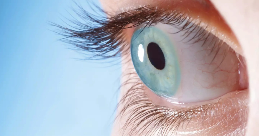 Doctor reveals what to do if you see eye floaters