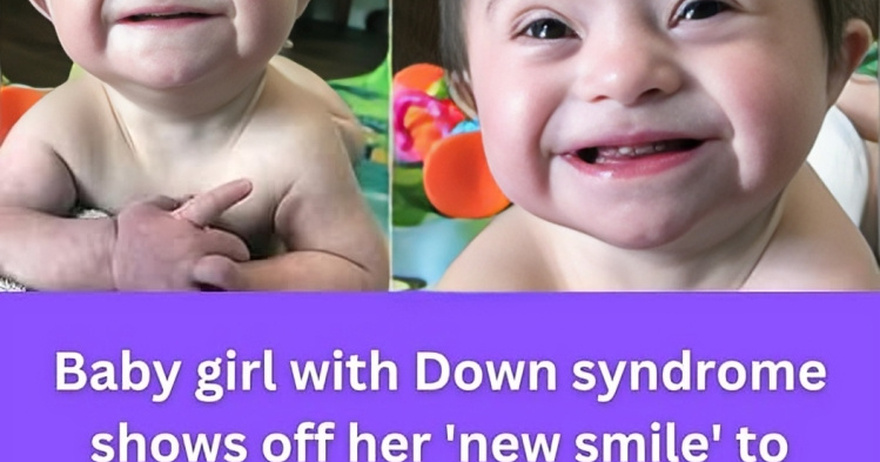 Adopted baby with Down syndrome goes viral after smiling for mom