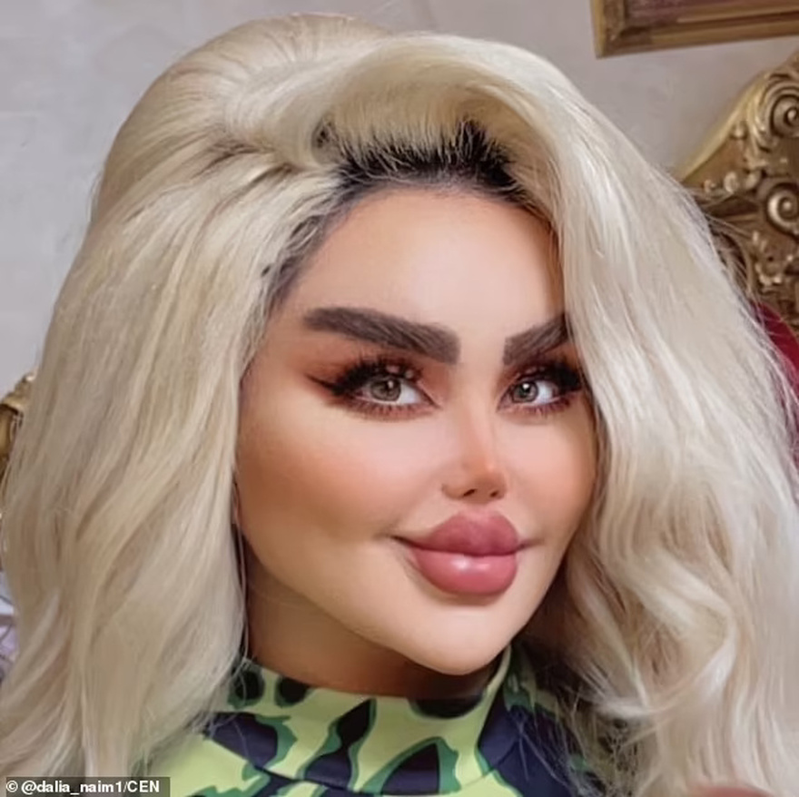 I’ve had 43 cosmetic procedures to become a Barbie doll lookalike – but critics say I look like a ‘zombie’