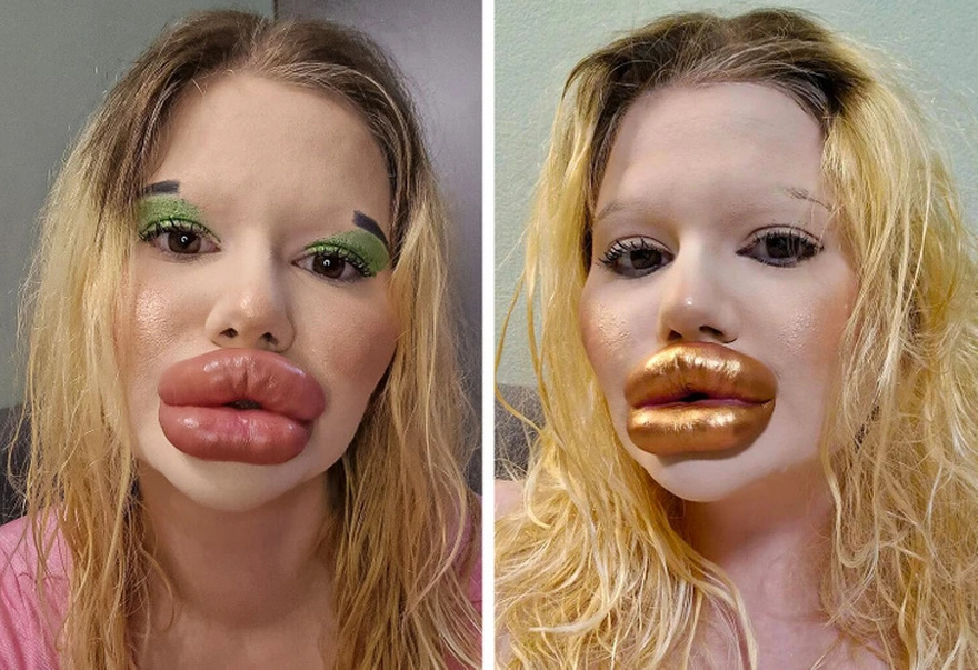 A Woman Does Injections to Look Like a Bratz Doll, Says People’s Comments Don’t Bother Her