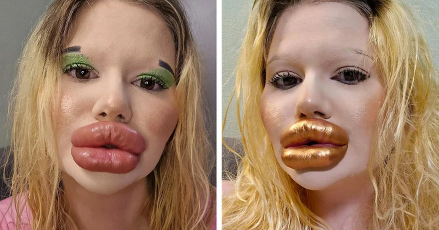 A Woman Does Injections to Look Like a Bratz Doll, Says People’s Comments Don’t Bother Her