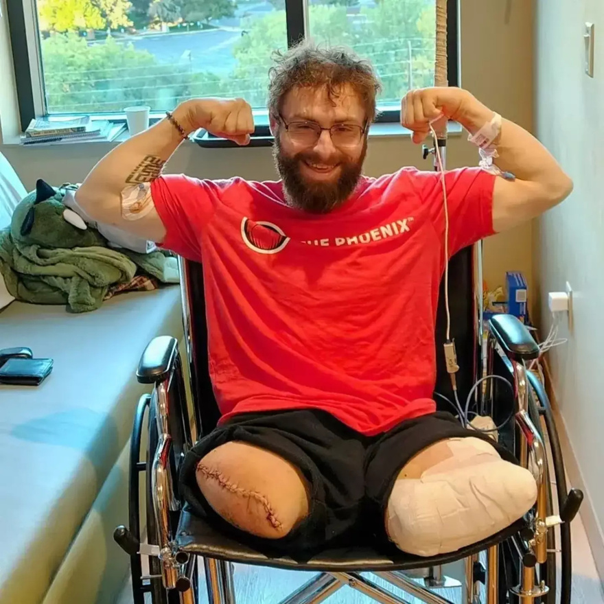 Man lost both legs minutes into first day in new job during freak accident that was ‘miracle’ he survived