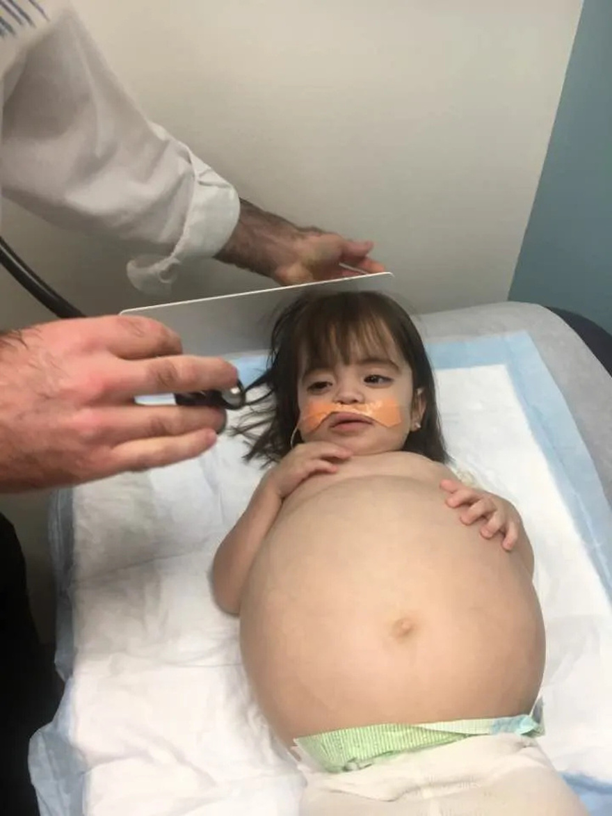 Little girl who looked 8 months’ pregnant because of deadly disease is saved thanks to dad’s kidney donation