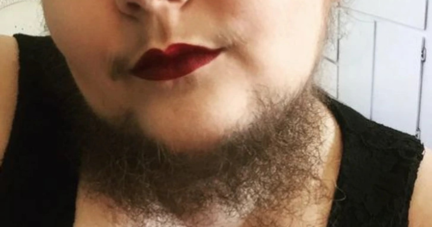 Meet the Lady Who Decided to Stop Removing Her Facial Hair and Embrace Every Inch of It