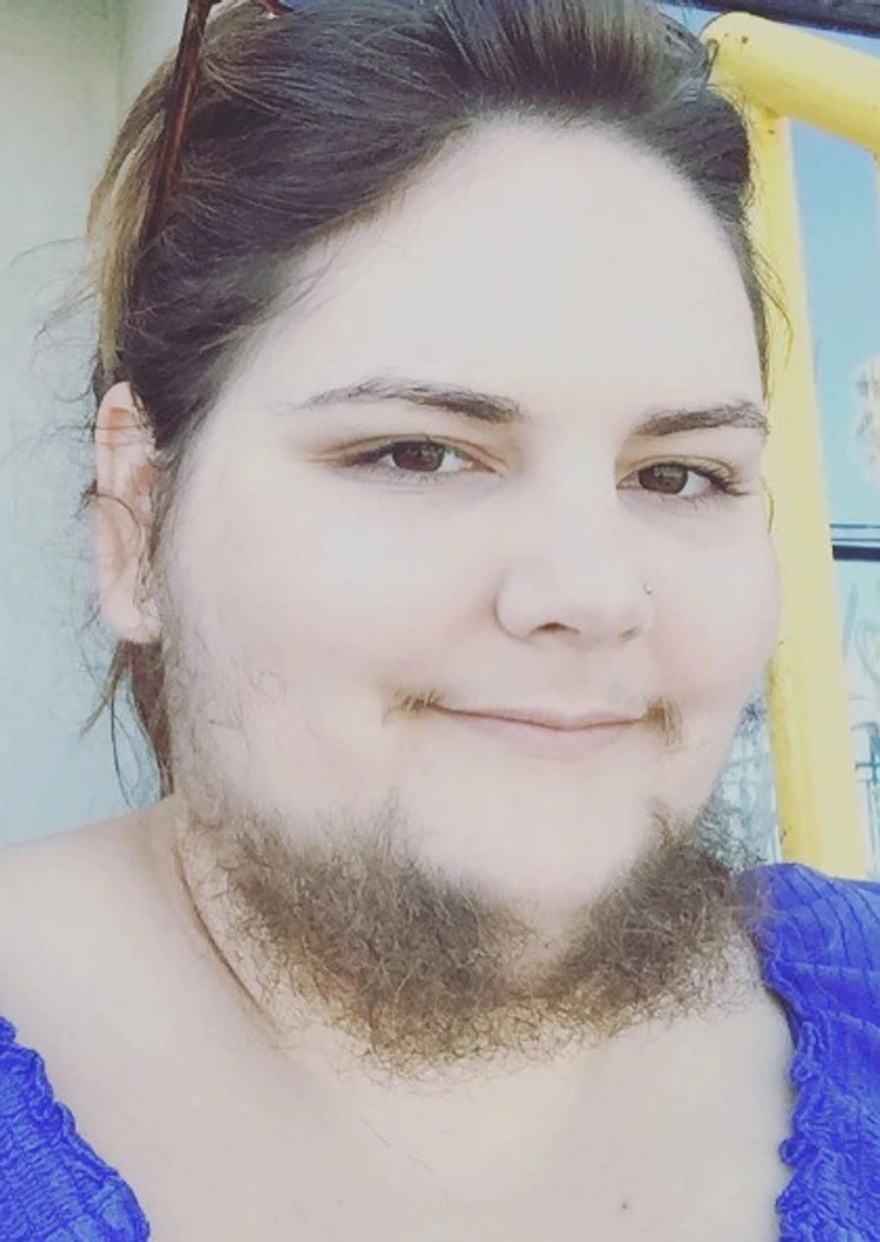 Meet the Lady Who Decided to Stop Removing Her Facial Hair and Embrace Every Inch of It