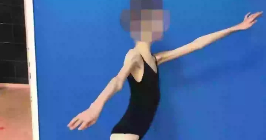 Parents who starved teenage ballerina daughter until she was four stone jailed for neglect