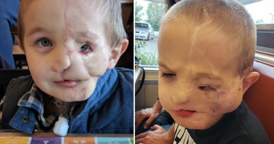 Boy, 5, survives savage attack by two dogs only to be called a ‘monster’ in public