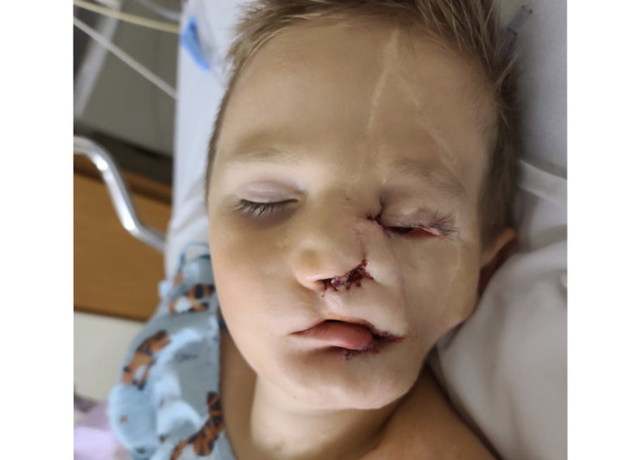 Boy, 5, survives savage attack by two dogs only to be called a ‘monster’ in public