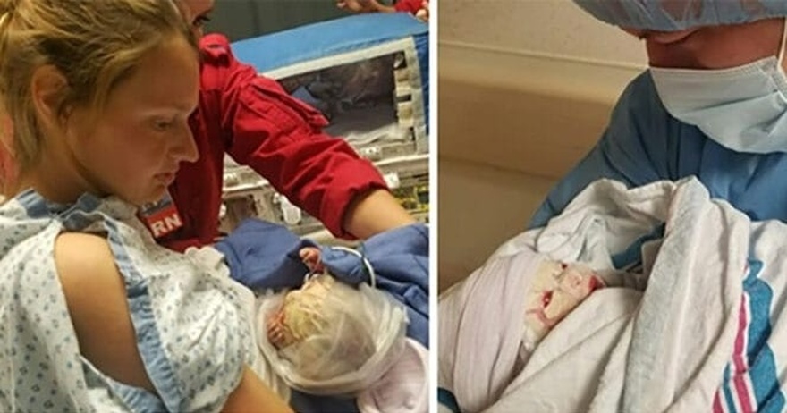 Doctors carry out an emergency C-section – then panic when baby’s face starts to change