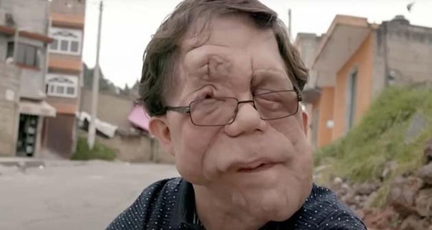 The incredible story of actor Adam Pearson: He’s an inspiration to millions