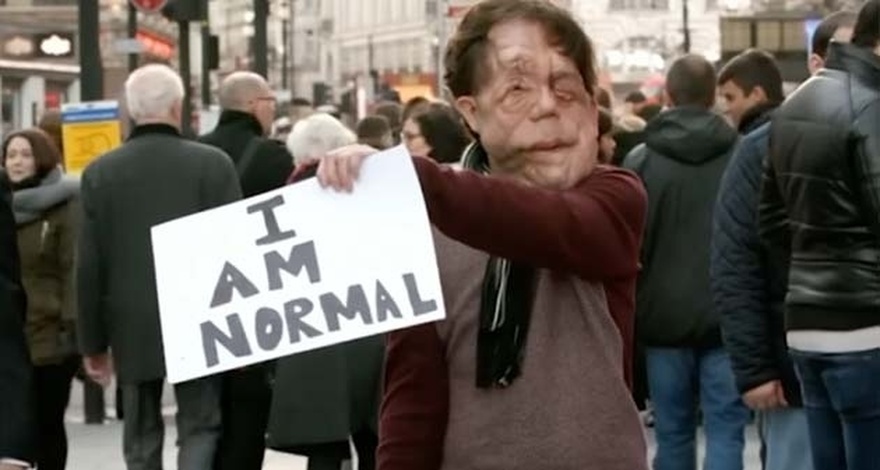 The incredible story of actor Adam Pearson: He’s an inspiration to millions