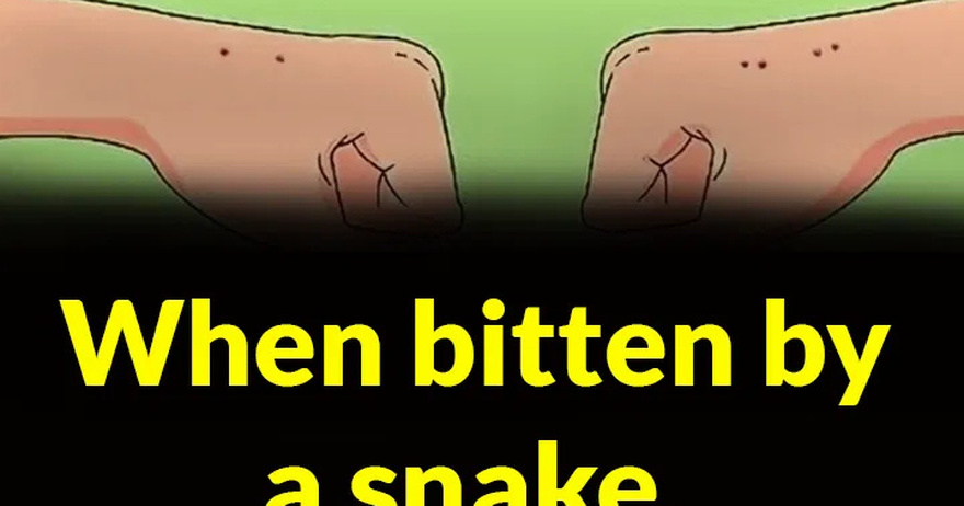 When bitten by a snake, you should do these things first