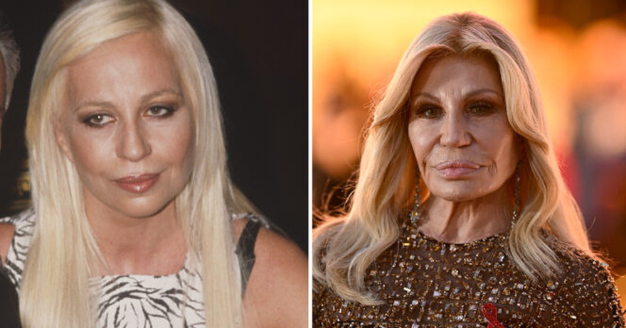 Donatella Versace’s new face leaves fans shaken