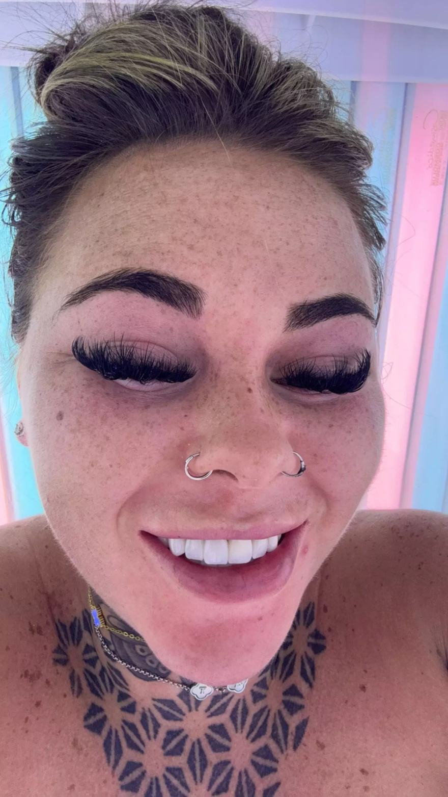 Influencer left horrified after accidentally burning skin off face while attempting ‘dangerous’ sunbed hack