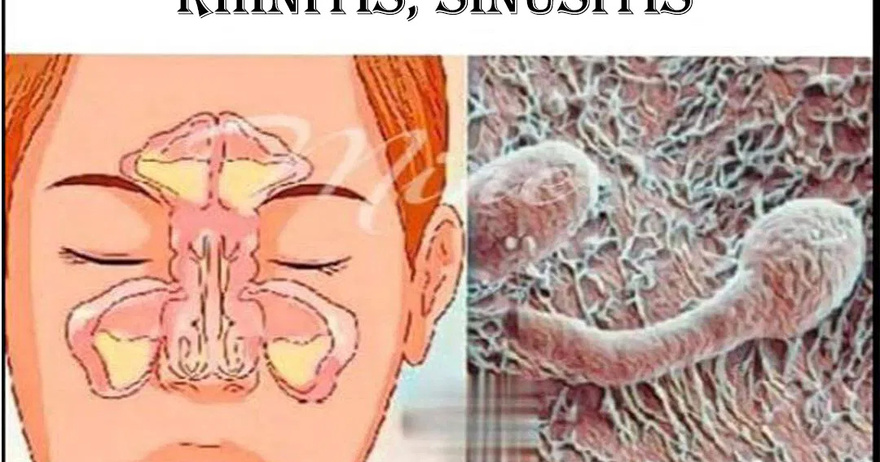 Effective natural remedies to relieve coughs and eliminate phlegm from the lungs