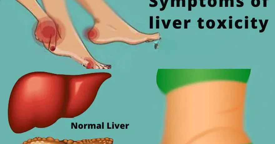 11 Signs Your Liver Is Not Working Well and Toxins Are Building Up in Your Body