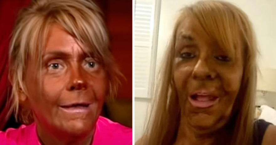 How Patricia Krentcil, “Tan Mom”, looks like today