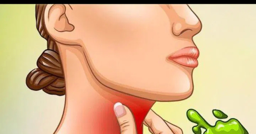 The Real Causes of Constant Phlegm and Mucus in Throat and How to Get Rid of It