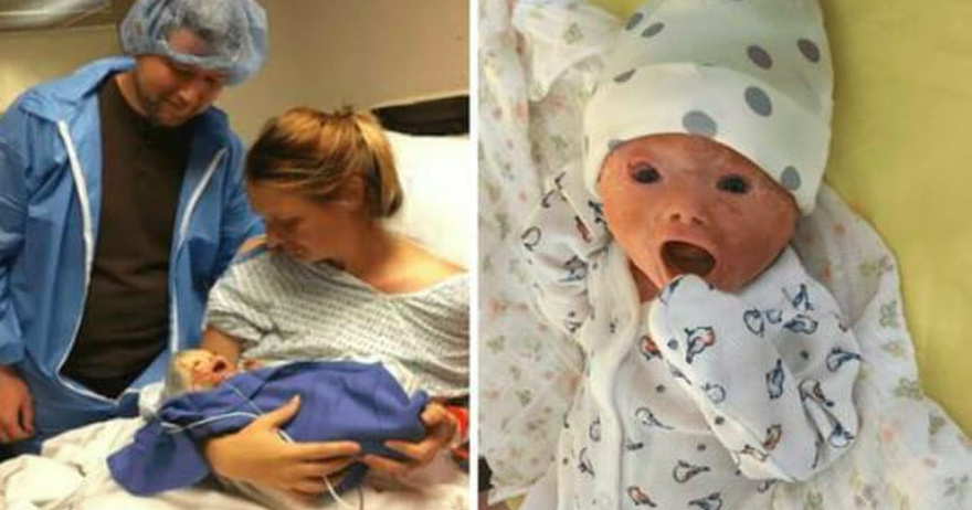 Doctors forced to do emergency caesarean section – dad sees baby’s face and room falls silent