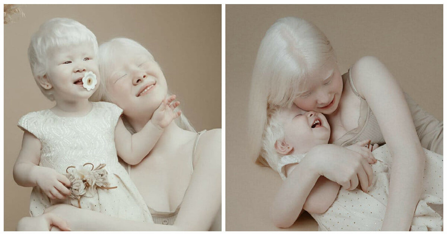 Albino sisters born 12 years apart become modeling sensations