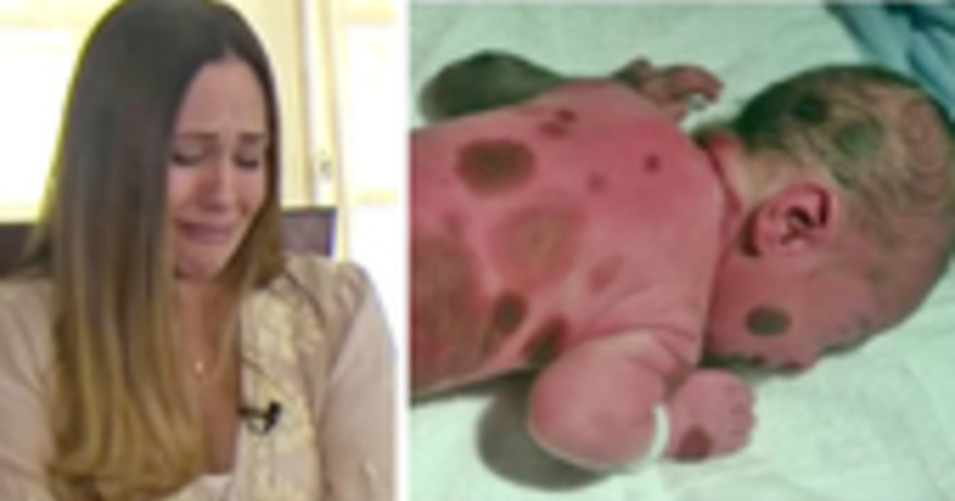 Baby is born with black spots , mom doesn’t dare go out with him